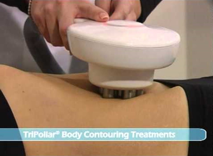 Cellulite Treatment in Toronto - Body Med Sculpt